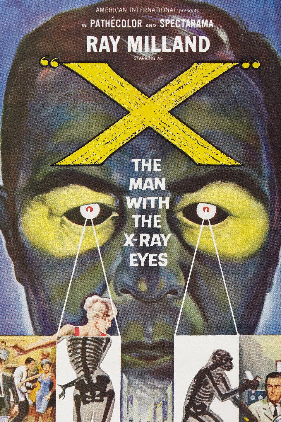 X-Ray-Eyes